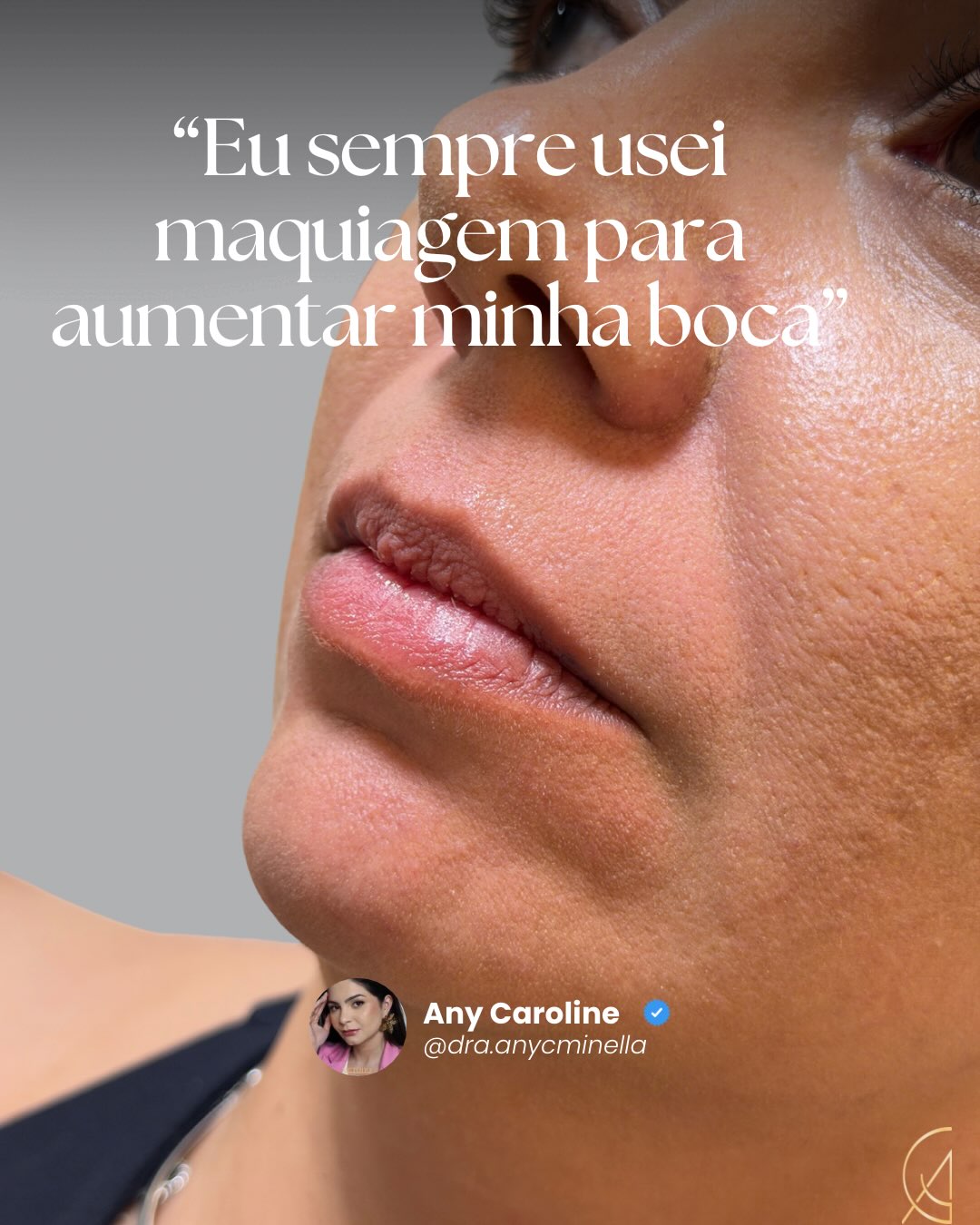 Uma história compartilhada. Registro original publicado no Instagram da Dra. Any